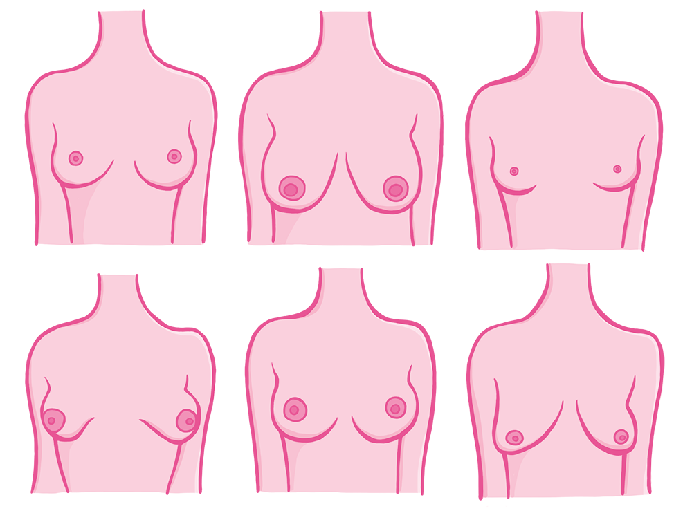 Pale Areolas