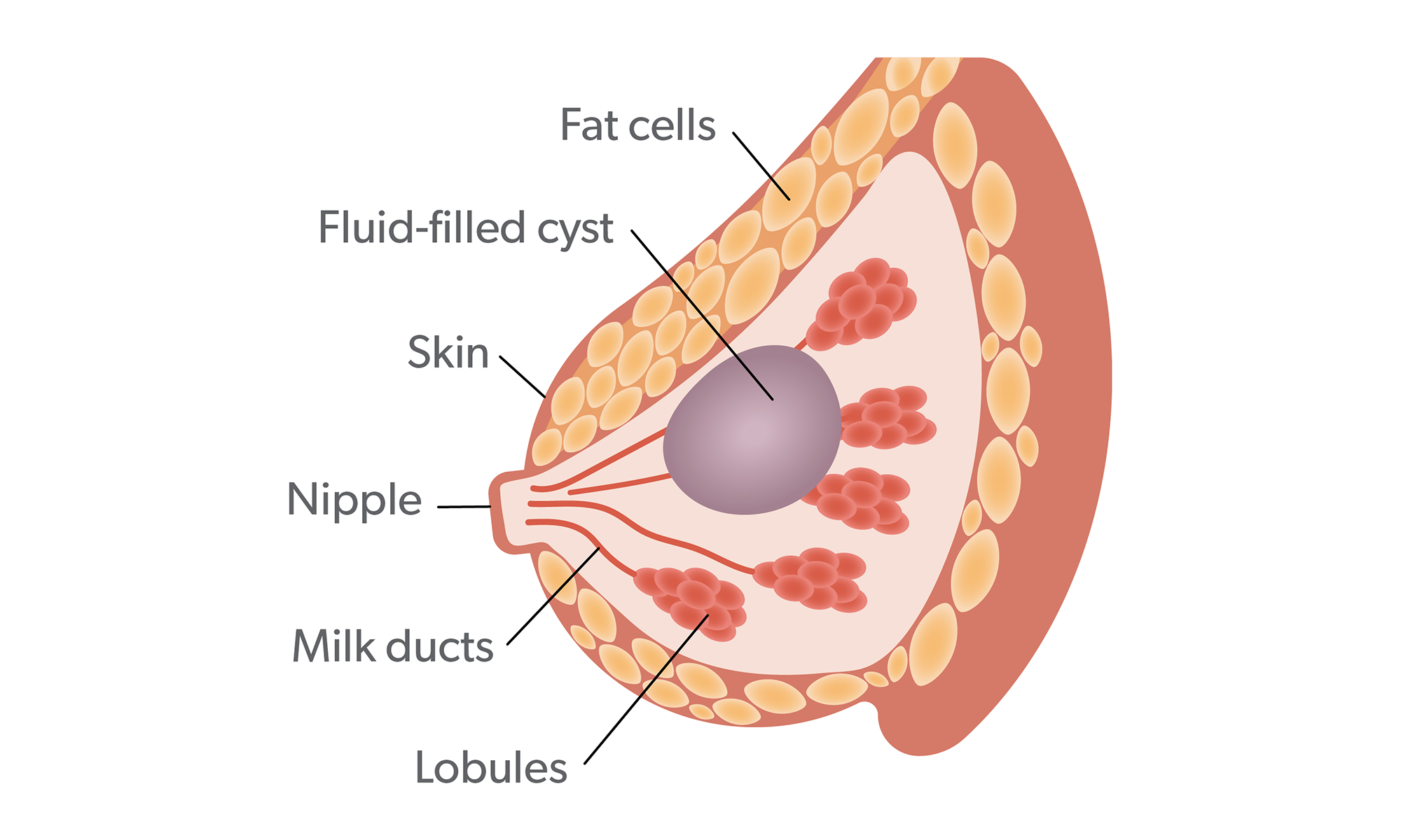 Breast lump diagram  Natural breast, Breast health, Breast