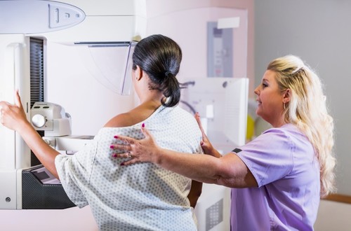 Breast cancer diagnoses are not “keeping pace with what we’ve seen in the past”