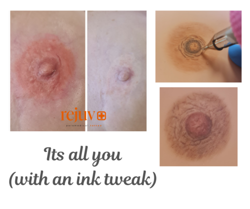 New advice issued to women about Covid-19 vaccinations and mammograms