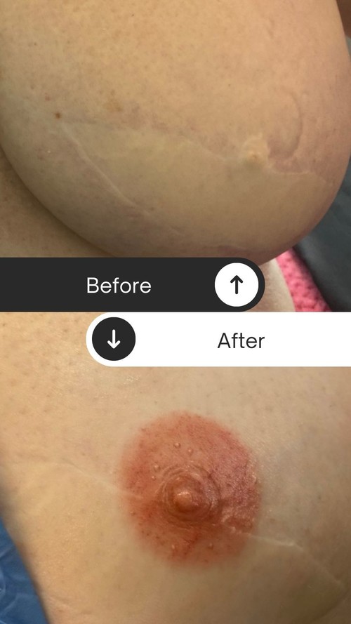 New advice issued to women about Covid-19 vaccinations and mammograms