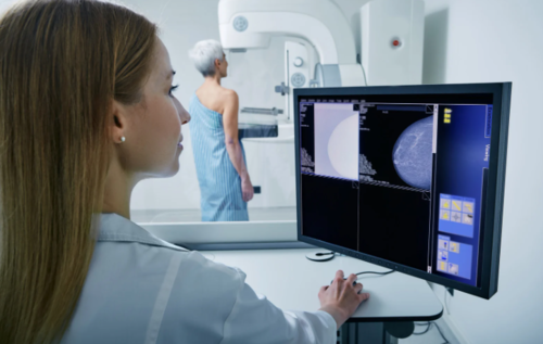 AI could transform breast screening: What it means for women in NZ