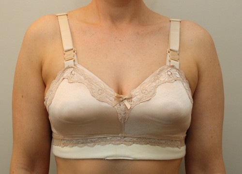 New advice issued to women about Covid-19 vaccinations and mammograms