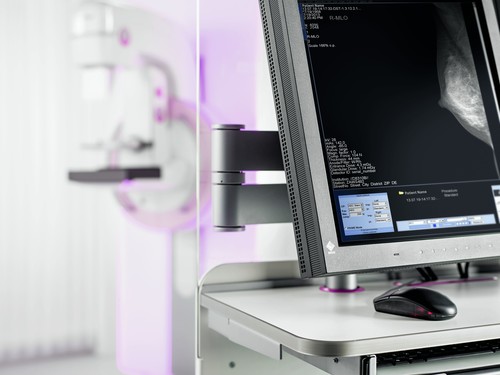 Access to 3D mammography for patients in Palmerston North