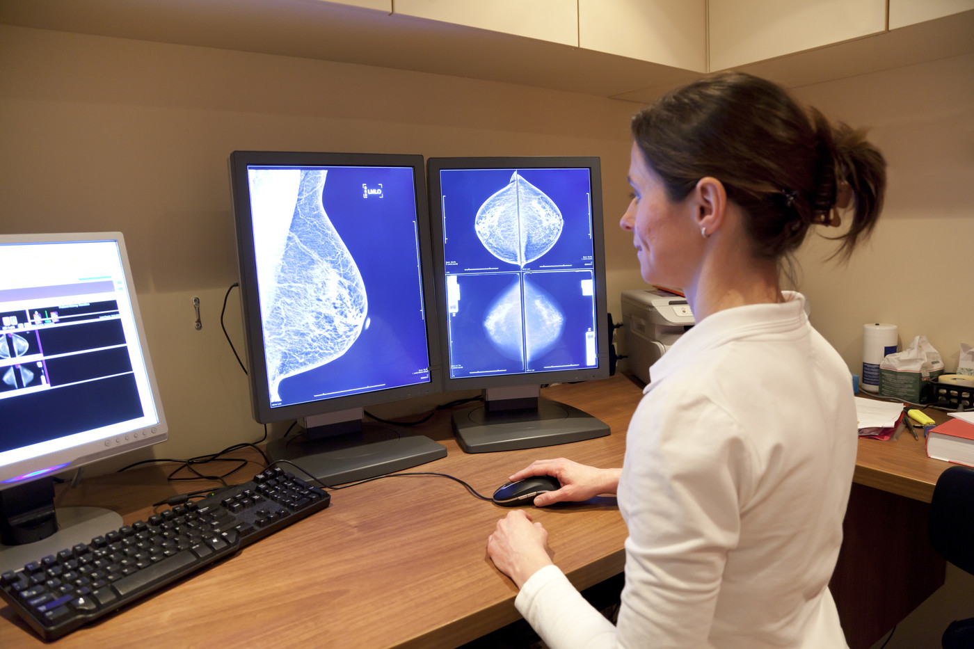 What about breast density?